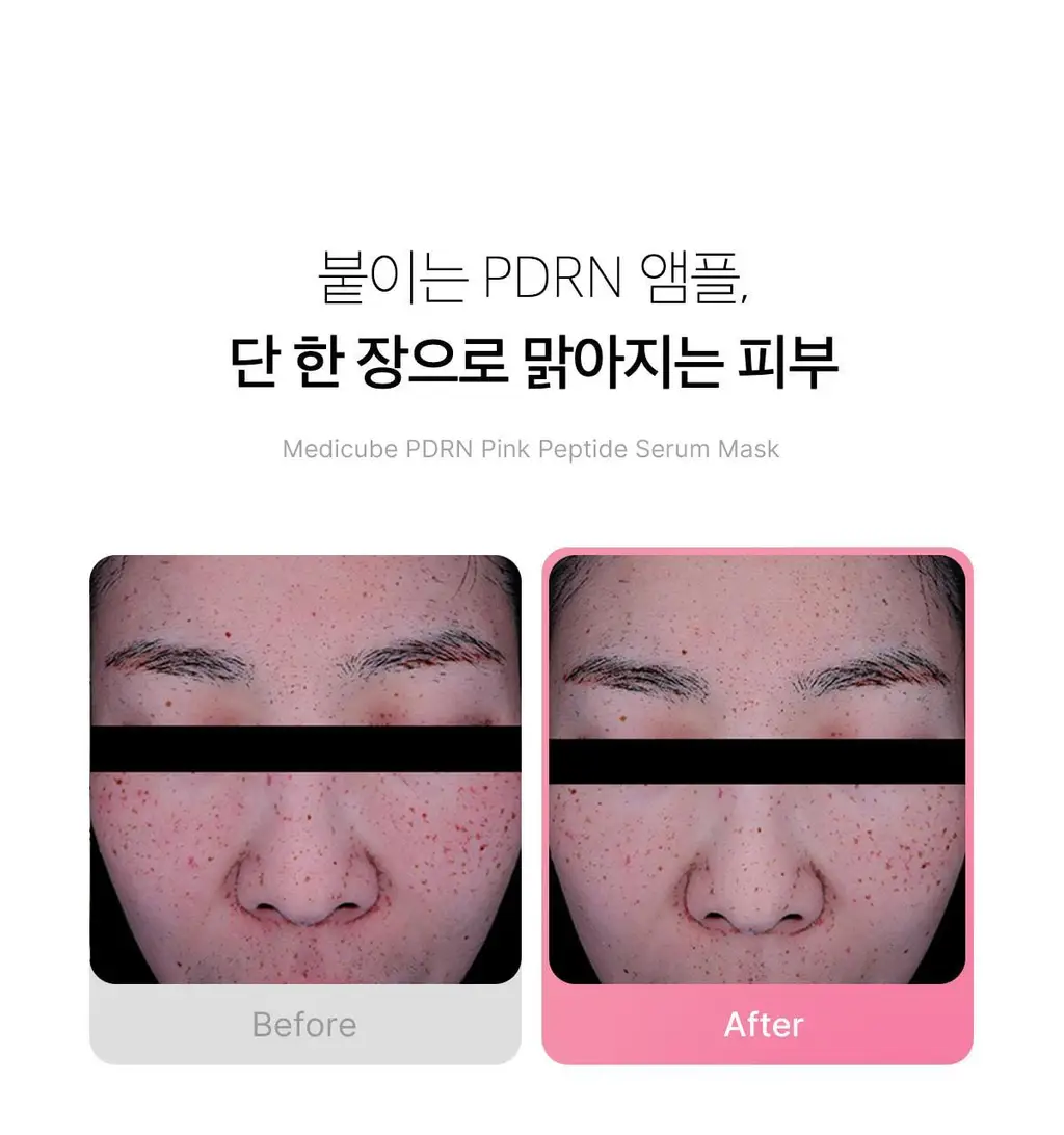 [NEW/5+1매 단독기획] 메디큐브 PDRN 핑크 펩타이드 앰플 마스크 5매 기획 (+1매) 상세페이지 3